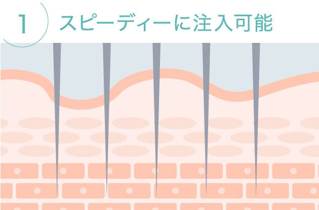 1. スピーディーに注入可能
