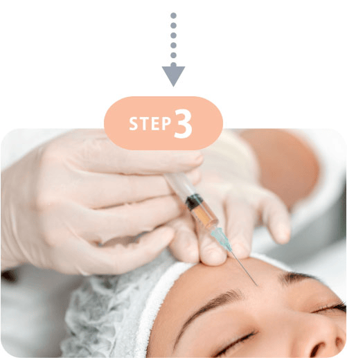 STEP3