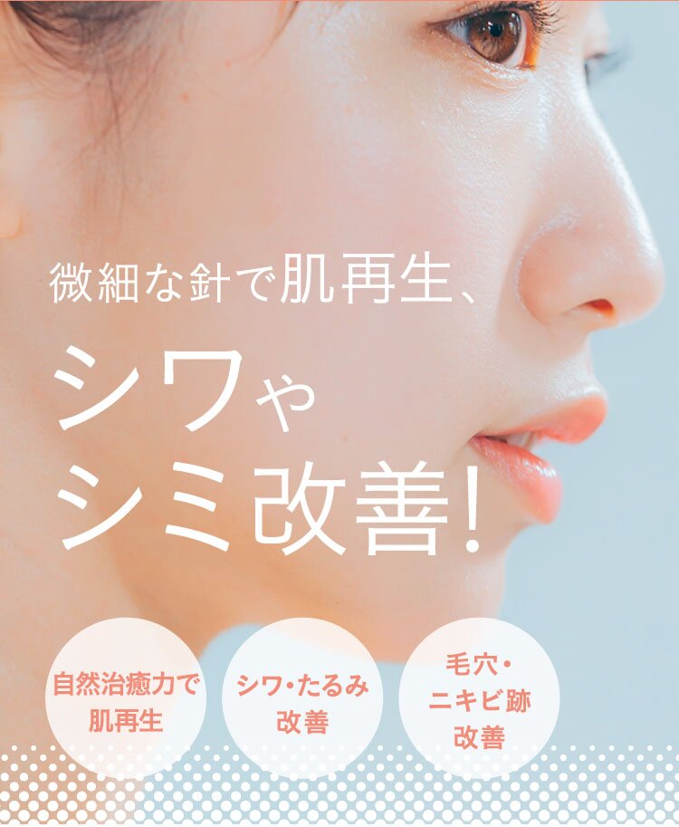 微細な針で肌再生、シワやシミ改善!